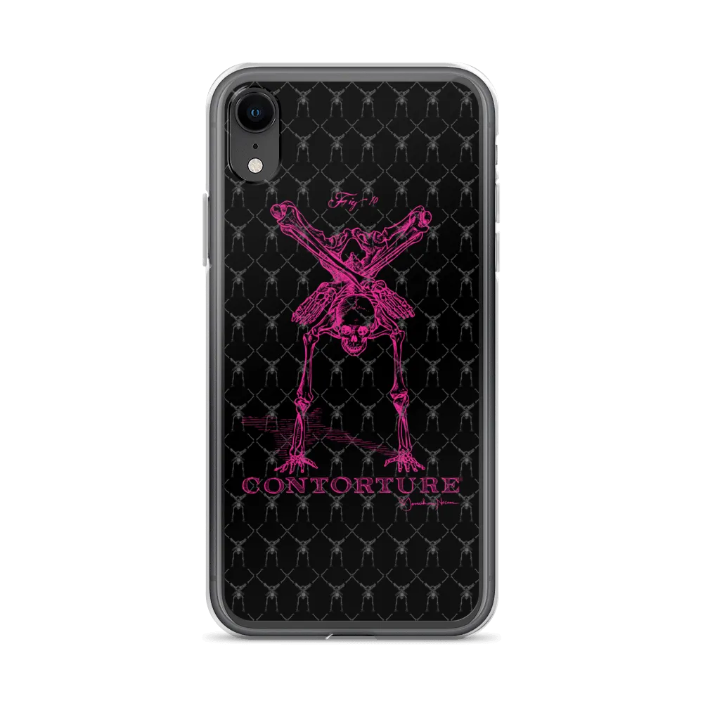 Contorture iPhone Case: Pinky Contortion Skeleton