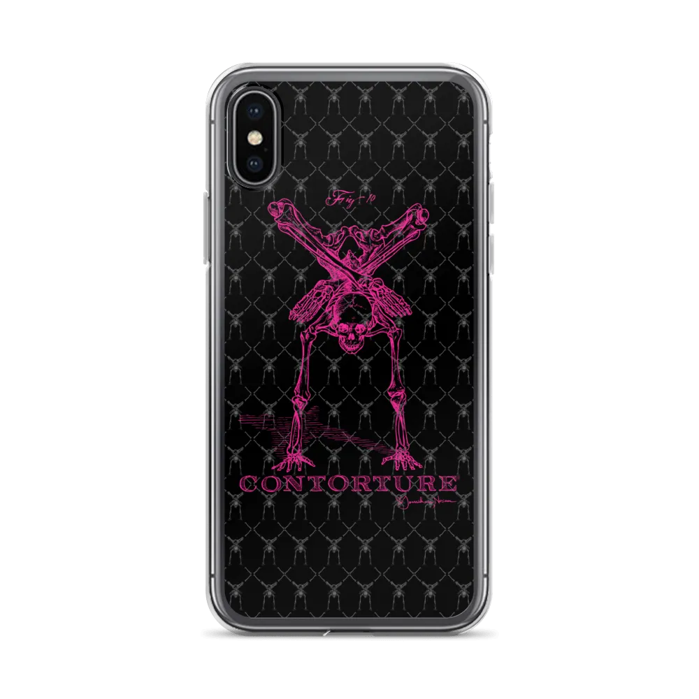 Contorture iPhone Case: Pinky Contortion Skeleton