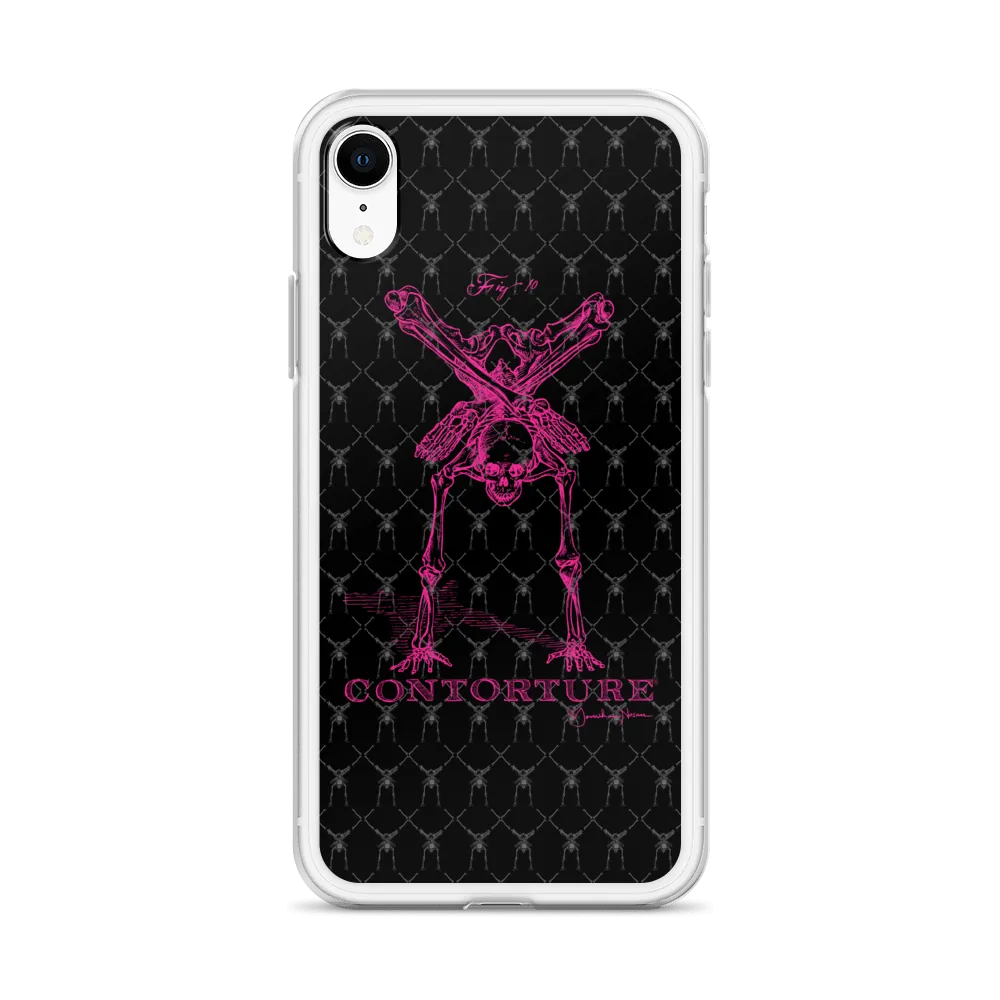 Contorture iPhone Case: Pinky Contortion Skeleton