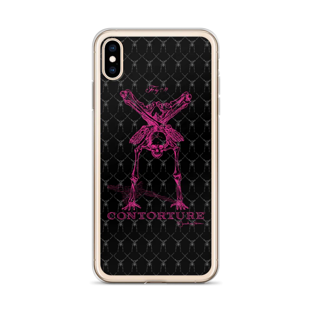 Contorture iPhone Case: Pinky Contortion Skeleton