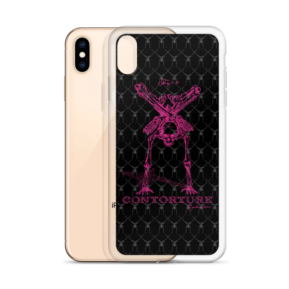 Contorture iPhone Case: Pinky Contortion Skeleton