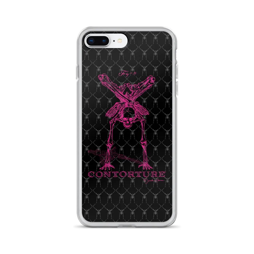 Contorture iPhone Case: Pinky Contortion Skeleton