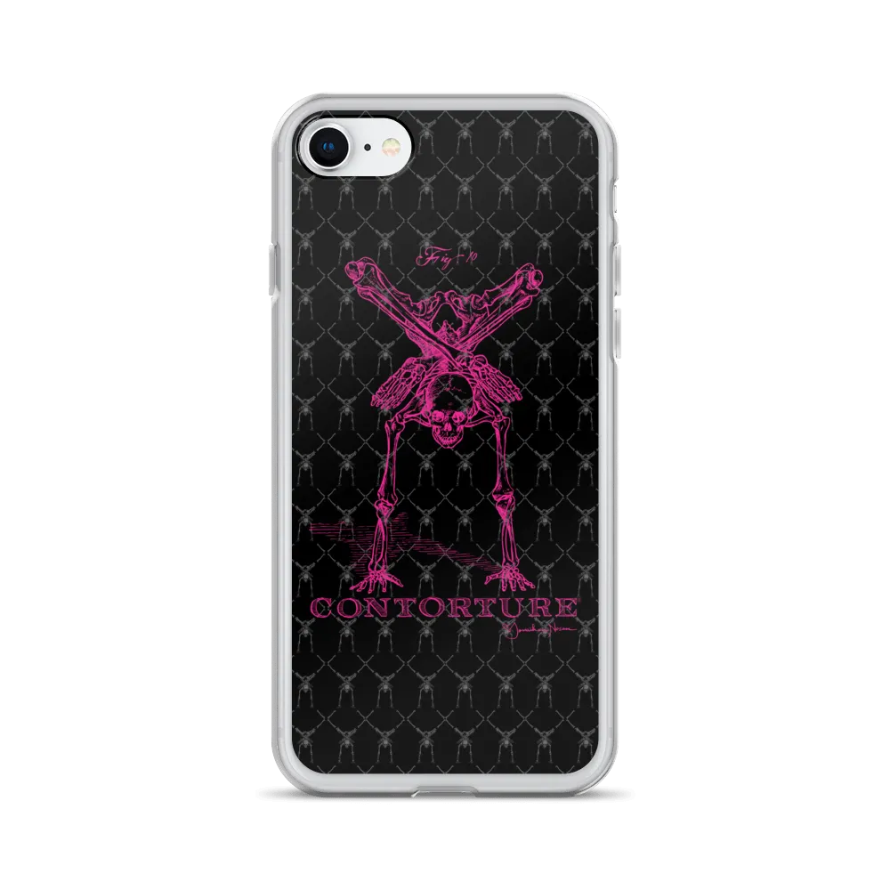 Contorture iPhone Case: Pinky Contortion Skeleton